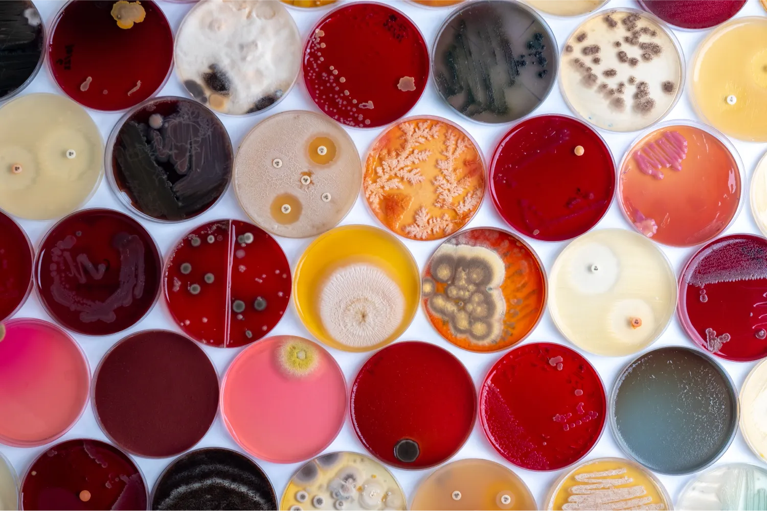 colorful bacteria cultures