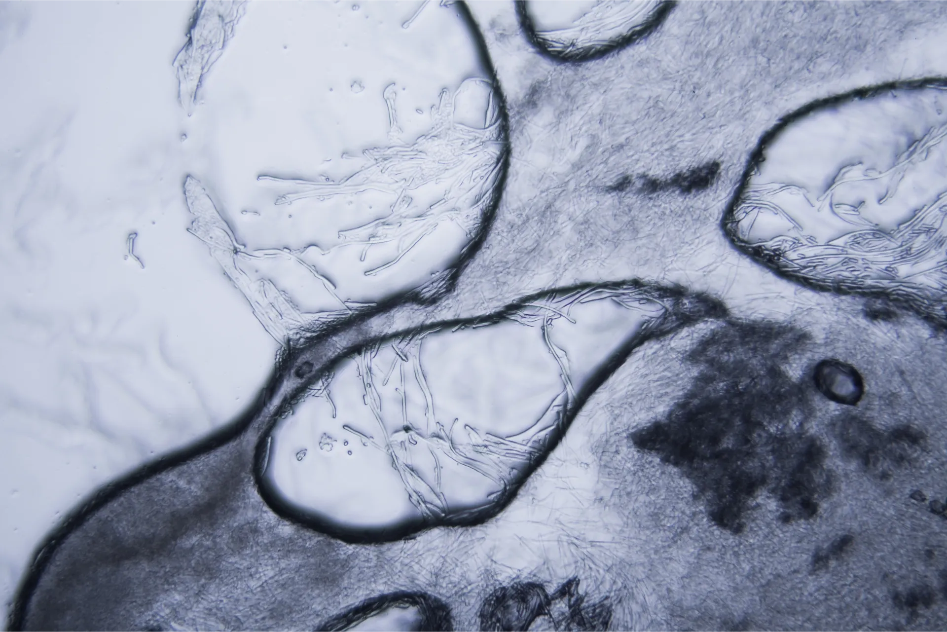 mold at the microscope