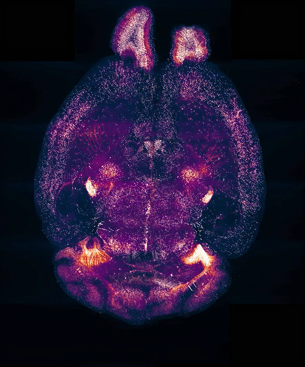 Cerebro